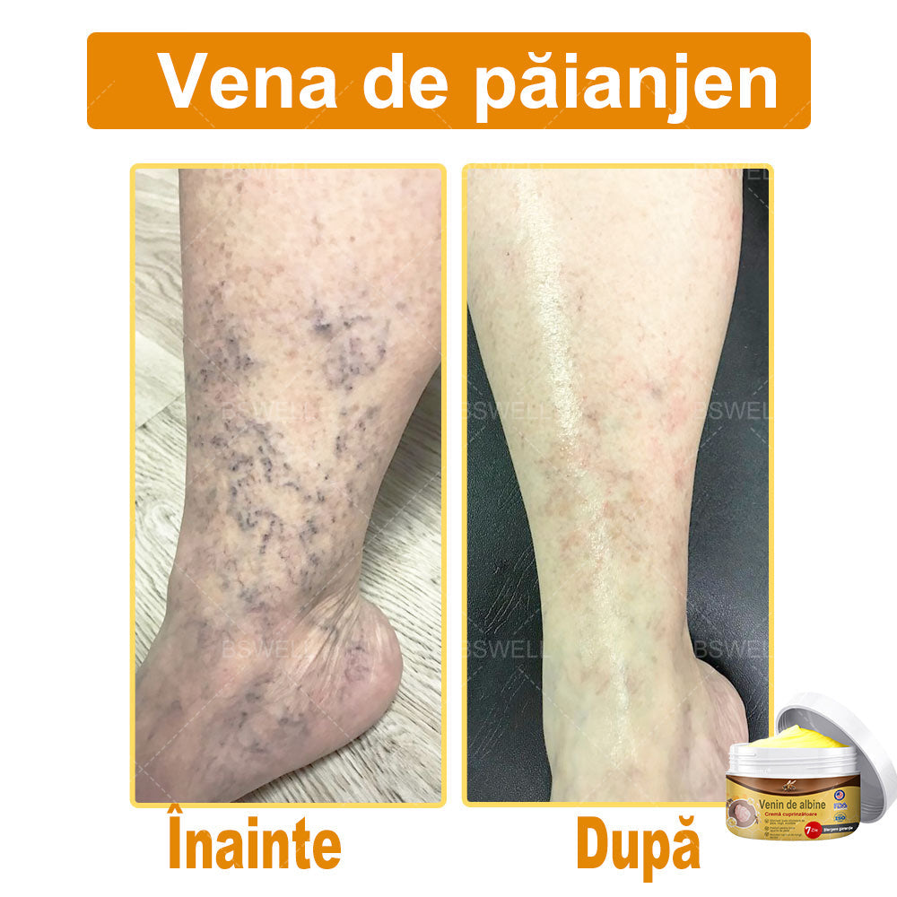 Doar 5 borcane! Profită de o reducere de 70%! Pielea ta va fi tânără și strălucitoare în 1-4 săptămâni. Nu rata ocazia—această ofertă revine abia anul viitor. Acționează repede! Garanție de returnare a banilor timp de 180 de zile!