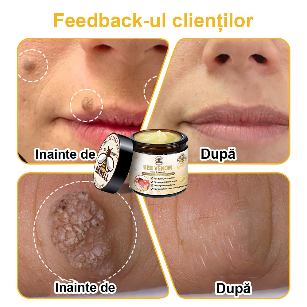 💎💎 𝐁𝐒𝐖𝐄𝐋𝐋® Cremă de tratare a pielii cu venin de albine (𝑆𝑢𝑔𝑒𝑟𝑎𝑡 𝑑𝑒 𝐼𝑁𝑆𝑃)