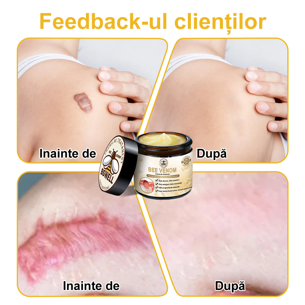 📢📢Ultimele 5 cutii, cu o reducere de 30% pentru dumneavoastră. Dacă ratați acum, anul viitor nu vor mai fi disponibile.