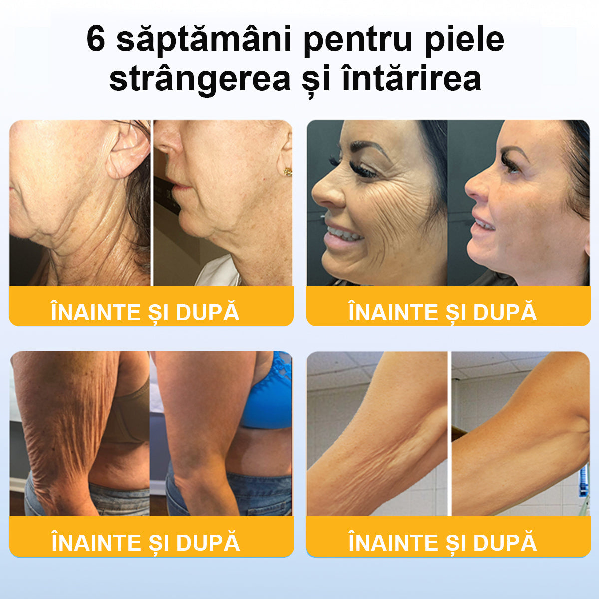 💃🏻𝐁𝐒𝐖𝐄𝐋𝐋® 𝐀𝐝𝐯𝐚𝐧𝐜𝐞𝐝 𝐅𝐢𝐫𝐦𝐢𝐧𝐠 & 𝐖𝐫𝐢𝐧𝐤𝐥𝐞-𝐑𝐞𝐝𝐮𝐜𝐢𝐧𝐠 𝐂𝐫𝐞𝐚𝐦: 𝐑𝐞𝐟𝐚𝐜𝐞 𝐞𝐥𝐚𝐬𝐭𝐢𝐜𝐢𝐭𝐚𝐭𝐞𝐚 𝐩𝐢𝐞𝐥𝐢𝐢 (👩🏻⚕️𝐑𝐞𝐜𝐨𝐦𝐦𝐞𝐧𝐝𝐞𝐝 𝐝𝐞 𝐜ă𝐭𝐫𝐞 𝐝𝐞𝐫𝐦𝐚𝐭𝐨𝐥𝐨𝐠𝐢&🔥𝐒𝐮𝐧𝐭 î𝐧 𝐜𝐮𝐫𝐬 𝐝𝐞 𝐝𝐞𝐬𝐟ăș𝐮𝐫𝐚𝐫𝐞 𝐩𝐫𝐨𝐦𝐨ț𝐢𝐢𝐥𝐞 𝐝𝐞 𝐯𝐚𝐫ă!)