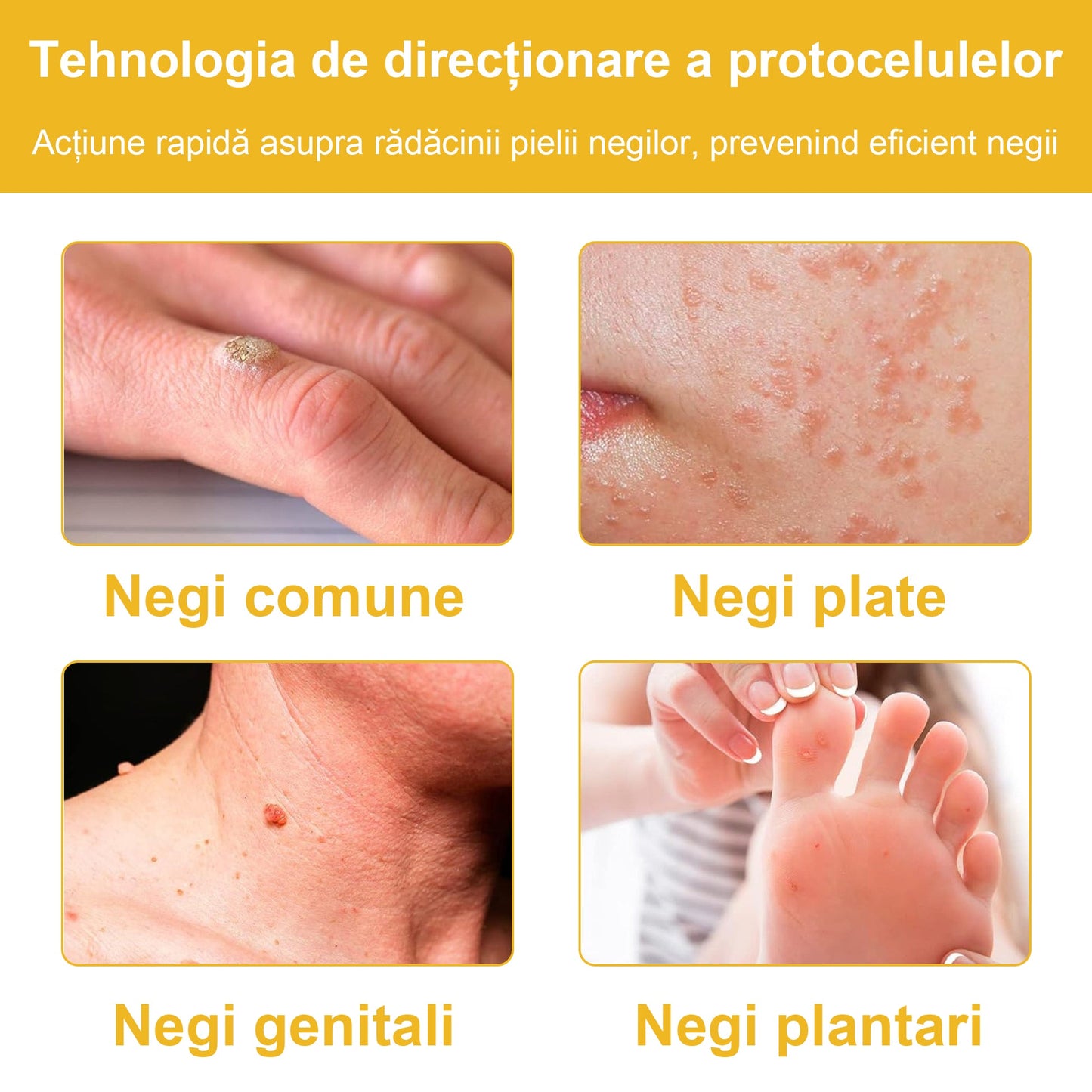 📢📢Ultimele 5 cutii, cu o reducere de 30% pentru dumneavoastră. Dacă ratați acum, anul viitor nu vor mai fi disponibile.