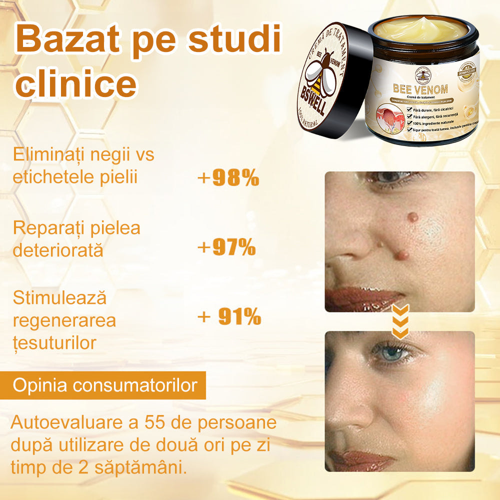 💎💎 𝐁𝐒𝐖𝐄𝐋𝐋® Cremă de tratare a pielii cu venin de albine (𝑆𝑢𝑔𝑒𝑟𝑎𝑡 𝑑𝑒 𝐼𝑁𝑆𝑃)