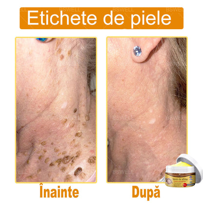 BSWELL® venin de albine cuprinzătoare cremă 🌿 Aprobat și recomandat de AAD