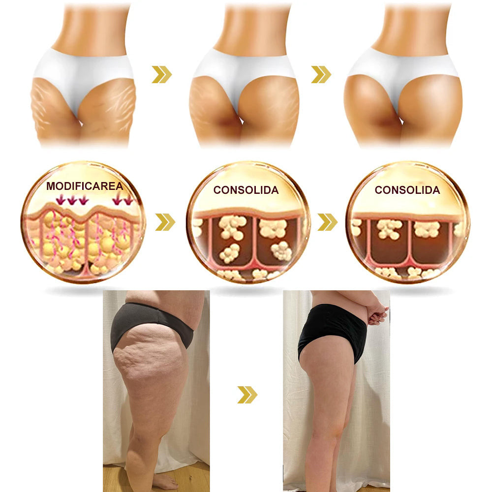 💃🏻𝐁𝐒𝐖𝐄𝐋𝐋® 𝐀𝐝𝐯𝐚𝐧𝐜𝐞𝐝 𝐅𝐢𝐫𝐦𝐢𝐧𝐠 & 𝐖𝐫𝐢𝐧𝐤𝐥𝐞-𝐑𝐞𝐝𝐮𝐜𝐢𝐧𝐠 𝐂𝐫𝐞𝐚𝐦: 𝐑𝐞𝐟𝐚𝐜𝐞 𝐞𝐥𝐚𝐬𝐭𝐢𝐜𝐢𝐭𝐚𝐭𝐞𝐚 𝐩𝐢𝐞𝐥𝐢𝐢 (👩🏻‍⚕️𝐑𝐞𝐜𝐨𝐦𝐦𝐞𝐧𝐝𝐞𝐝 𝐝𝐞 𝐜ă𝐭𝐫𝐞 𝐝𝐞𝐫𝐦𝐚𝐭𝐨𝐥𝐨𝐠𝐢&🔥𝐒𝐮𝐧𝐭 î𝐧 𝐜𝐮𝐫𝐬 𝐝𝐞 𝐝𝐞𝐬𝐟ăș𝐮𝐫𝐚𝐫𝐞 𝐩𝐫𝐨𝐦𝐨ț𝐢𝐢𝐥𝐞 𝐝𝐞 𝐯𝐚𝐫ă!)