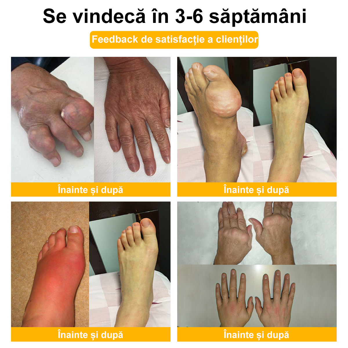 💪𝐅𝐥𝐞𝐱𝐢𝐑𝐞𝐥𝐢𝐞𝐟® 𝐕𝐞𝐧𝐢𝐧 𝐝𝐞 𝐀𝐥𝐛𝐢𝐧𝐞 𝐀𝐯𝐚𝐧𝐬𝐚𝐭ă 𝐀𝐫𝐭𝐢𝐜𝐮𝐥𝐚ț𝐢𝐢𝐥𝐨𝐫 ș𝐢 𝐎𝐚𝐬𝐞𝐥𝐨𝐫 𝐓𝐞𝐫𝐚𝐩𝐢𝐚 𝐂𝐫𝐞𝐦ă  (𝐞𝐱𝐭𝐫𝐚𝐜𝐭 𝐝𝐞 𝐚𝐥𝐛𝐢𝐧𝐞 𝐝𝐢𝐧 𝐧𝐨𝐮𝐚 𝐳𝐞𝐞𝐥𝐚𝐧𝐝ă - 𝐞𝐬𝐭𝐞 𝐬𝐩𝐞𝐜𝐢𝐚𝐥𝐢𝐳𝐚𝐭 î𝐧 𝐛𝐨𝐥𝐢 𝐨𝐫𝐭𝐨𝐩𝐞𝐝𝐢𝐜𝐞 ș𝐢 𝐝𝐮𝐫𝐞𝐫𝐢 𝐚𝐫𝐭𝐫𝐢𝐭𝐢𝐜𝐞) 💖💖