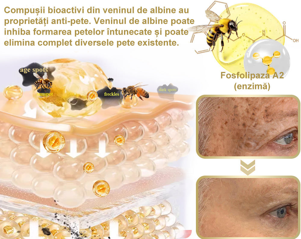 Doar 5 borcane! Prinde acum 30% reducere și obține o piele tânără și strălucitoare în 1-4 săptămâni. Nu rata oferta—nu se va repeta! Garanție returnare bani 180 de zile!