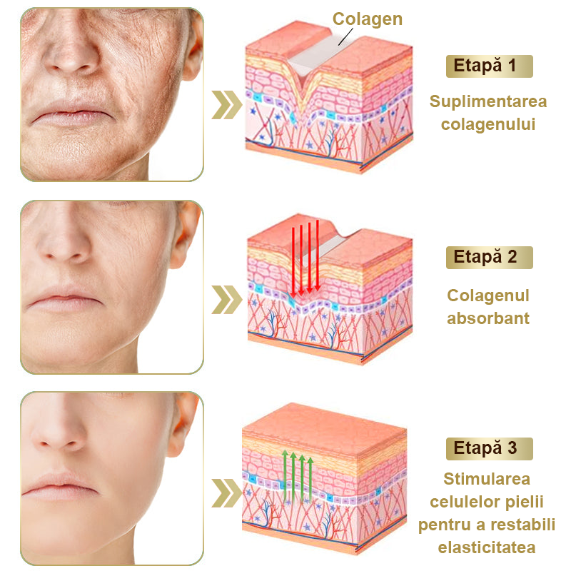 Doar 5 borcane! Prinde acum 30% reducere și obține o piele tânără și strălucitoare în 1-4 săptămâni. Nu rata oferta—nu se va repeta! Garanție returnare bani 180 de zile!