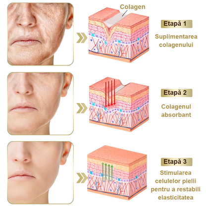 Doar 5 borcane! Prinde acum 30% reducere și obține o piele tânără și strălucitoare în 1-4 săptămâni. Nu rata oferta—nu se va repeta! Garanție returnare bani 180 de zile!