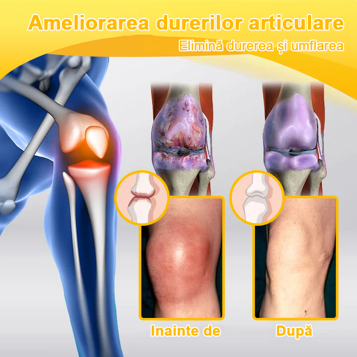 💪𝐅𝐥𝐞𝐱𝐢𝐑𝐞𝐥𝐢𝐞𝐟® 𝐕𝐞𝐧𝐢𝐧 𝐝𝐞 𝐀𝐥𝐛𝐢𝐧𝐞 𝐀𝐯𝐚𝐧𝐬𝐚𝐭ă 𝐀𝐫𝐭𝐢𝐜𝐮𝐥𝐚ț𝐢𝐢𝐥𝐨𝐫 ș𝐢 𝐎𝐚𝐬𝐞𝐥𝐨𝐫 𝐓𝐞𝐫𝐚𝐩𝐢𝐚 𝐂𝐫𝐞𝐦ă  (𝐞𝐱𝐭𝐫𝐚𝐜𝐭 𝐝𝐞 𝐚𝐥𝐛𝐢𝐧𝐞 𝐝𝐢𝐧 𝐧𝐨𝐮𝐚 𝐳𝐞𝐞𝐥𝐚𝐧𝐝ă - 𝐞𝐬𝐭𝐞 𝐬𝐩𝐞𝐜𝐢𝐚𝐥𝐢𝐳𝐚𝐭 î𝐧 𝐛𝐨𝐥𝐢 𝐨𝐫𝐭𝐨𝐩𝐞𝐝𝐢𝐜𝐞 ș𝐢 𝐝𝐮𝐫𝐞𝐫𝐢 𝐚𝐫𝐭𝐫𝐢𝐭𝐢𝐜𝐞) 💖💖