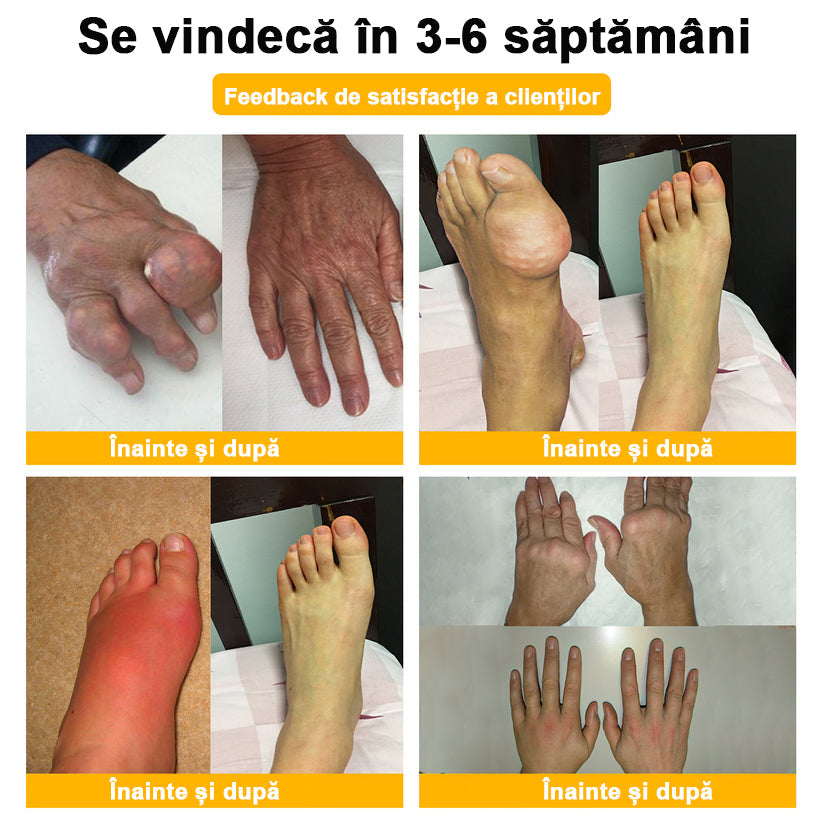 𝐁𝐒𝐖𝐄𝐋𝐋® Venin de Albine Alinarea Durerii Vindecarea Oaselor Cremă🌱𝐀𝐀𝐎𝐒 recomandă (Specializat în boli ortopedice și dureri)🌈