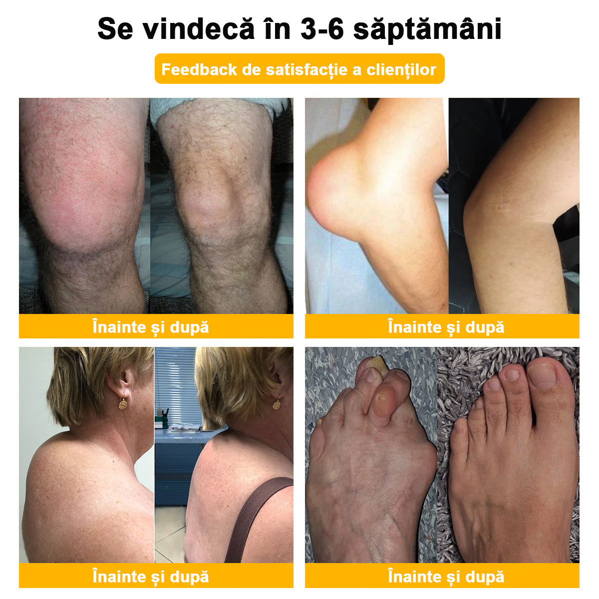 𝐁𝐒𝐖𝐄𝐋𝐋® Venin de Albine Alinarea Durerii Vindecarea Oaselor Cremă🌱𝐀𝐀𝐎𝐒 recomandă (Specializat în boli ortopedice și dureri)🌈
