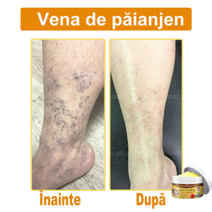 BSWELL® venin de albine cuprinzătoare cremă 🌿 Aprobat și recomandat de AAD