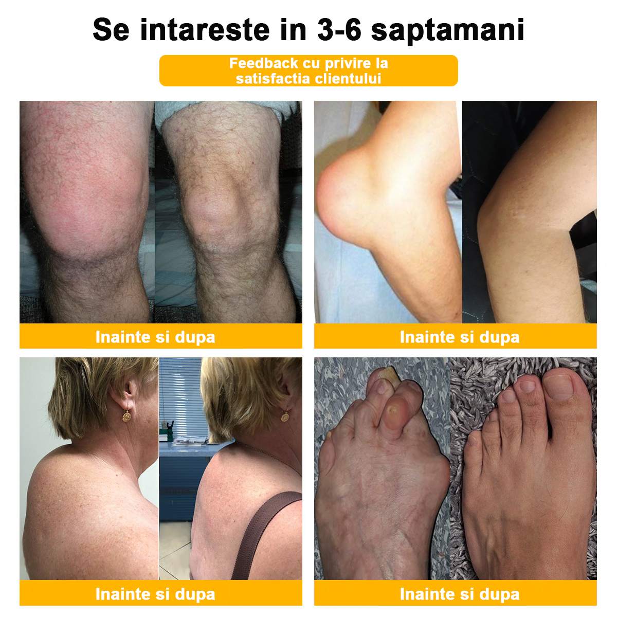💪𝐅𝐥𝐞𝐱𝐢𝐑𝐞𝐥𝐢𝐞𝐟® 𝐕𝐞𝐧𝐢𝐧 𝐝𝐞 𝐀𝐥𝐛𝐢𝐧𝐞 𝐀𝐯𝐚𝐧𝐬𝐚𝐭ă 𝐀𝐫𝐭𝐢𝐜𝐮𝐥𝐚ț𝐢𝐢𝐥𝐨𝐫 ș𝐢 𝐎𝐚𝐬𝐞𝐥𝐨𝐫 𝐓𝐞𝐫𝐚𝐩𝐢𝐚 𝐂𝐫𝐞𝐦ă  (𝐞𝐱𝐭𝐫𝐚𝐜𝐭 𝐝𝐞 𝐚𝐥𝐛𝐢𝐧𝐞 𝐝𝐢𝐧 𝐧𝐨𝐮𝐚 𝐳𝐞𝐞𝐥𝐚𝐧𝐝ă - 𝐞𝐬𝐭𝐞 𝐬𝐩𝐞𝐜𝐢𝐚𝐥𝐢𝐳𝐚𝐭 î𝐧 𝐛𝐨𝐥𝐢 𝐨𝐫𝐭𝐨𝐩𝐞𝐝𝐢𝐜𝐞 ș𝐢 𝐝𝐮𝐫𝐞𝐫𝐢 𝐚𝐫𝐭𝐫𝐢𝐭𝐢𝐜𝐞) 💖💖
