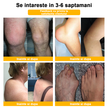 💪𝐅𝐥𝐞𝐱𝐢𝐑𝐞𝐥𝐢𝐞𝐟® 𝐕𝐞𝐧𝐢𝐧 𝐝𝐞 𝐀𝐥𝐛𝐢𝐧𝐞 𝐀𝐯𝐚𝐧𝐬𝐚𝐭ă 𝐀𝐫𝐭𝐢𝐜𝐮𝐥𝐚ț𝐢𝐢𝐥𝐨𝐫 ș𝐢 𝐎𝐚𝐬𝐞𝐥𝐨𝐫 𝐓𝐞𝐫𝐚𝐩𝐢𝐚 𝐂𝐫𝐞𝐦ă  (𝐞𝐱𝐭𝐫𝐚𝐜𝐭 𝐝𝐞 𝐚𝐥𝐛𝐢𝐧𝐞 𝐝𝐢𝐧 𝐧𝐨𝐮𝐚 𝐳𝐞𝐞𝐥𝐚𝐧𝐝ă - 𝐞𝐬𝐭𝐞 𝐬𝐩𝐞𝐜𝐢𝐚𝐥𝐢𝐳𝐚𝐭 î𝐧 𝐛𝐨𝐥𝐢 𝐨𝐫𝐭𝐨𝐩𝐞𝐝𝐢𝐜𝐞 ș𝐢 𝐝𝐮𝐫𝐞𝐫𝐢 𝐚𝐫𝐭𝐫𝐢𝐭𝐢𝐜𝐞) 💖💖