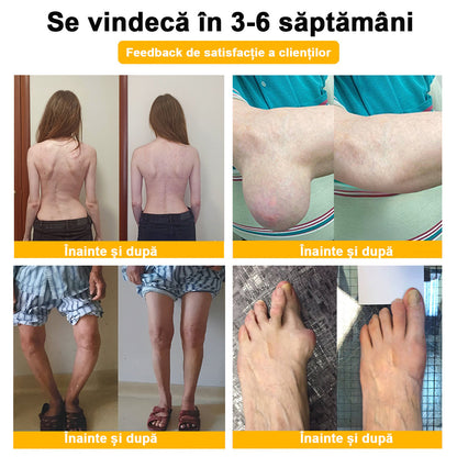 𝐁𝐒𝐖𝐄𝐋𝐋® Venin de Albine Alinarea Durerii Vindecarea Oaselor Cremă🌱𝐀𝐀𝐎𝐒 recomandă (Specializat în boli ortopedice și dureri)🌈