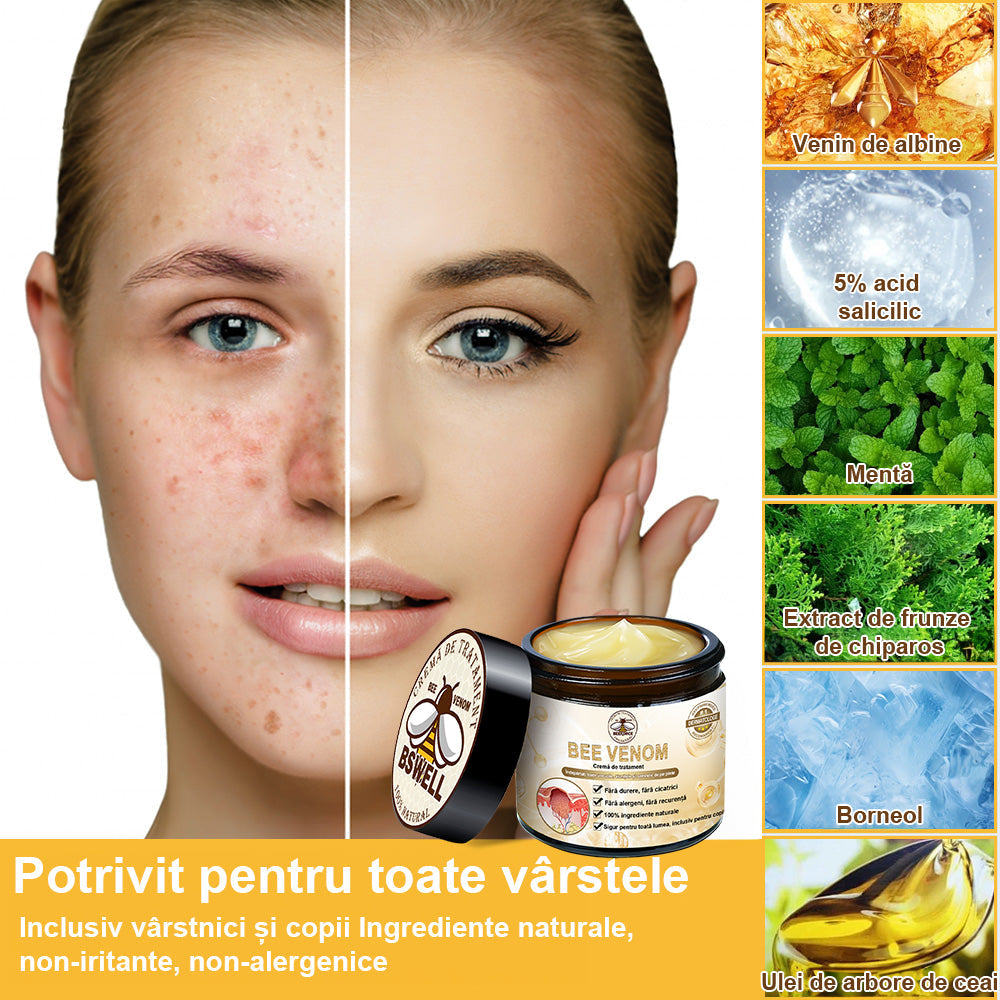 💎 𝐁𝐒𝐖𝐄𝐋𝐋® Cremă de tratare a pielii cu venin de albine (𝑆𝑢𝑔𝑒𝑟𝑎𝑡 𝑑𝑒 𝐼𝑁𝑆𝑃)