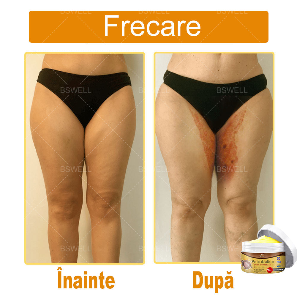 BSWELL® venin de albine cuprinzătoare cremă 🌿 Aprobat și recomandat de AAD