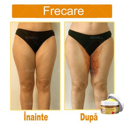 BSWELL® venin de albine cuprinzătoare cremă 🌿 Aprobat și recomandat de AAD