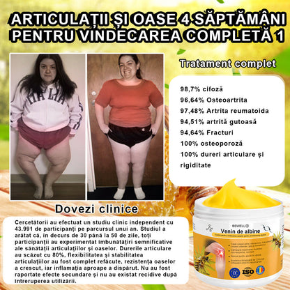 𝐁𝐒𝐖𝐄𝐋𝐋® Venin de Albine Alinarea Durerii Vindecarea Oaselor Cremă🌱𝐀𝐀𝐎𝐒 recomandă (Specializat în boli ortopedice și dureri)🌈