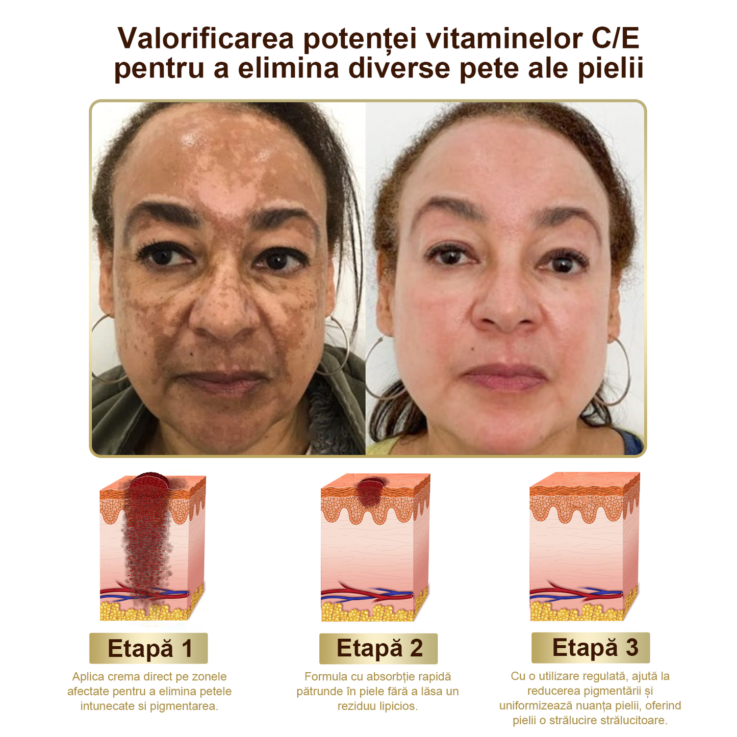 Doar 5 borcane! Prinde acum 30% reducere și obține o piele tânără și strălucitoare în 1-4 săptămâni. Nu rata oferta—nu se va repeta! Garanție returnare bani 180 de zile!