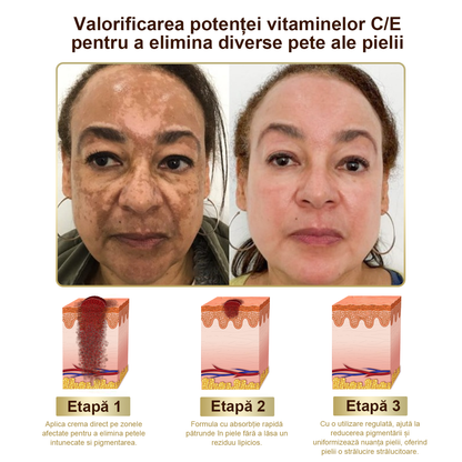 Doar 5 borcane! Prinde acum 30% reducere și obține o piele tânără și strălucitoare în 1-4 săptămâni. Nu rata oferta—nu se va repeta! Garanție returnare bani 180 de zile!
