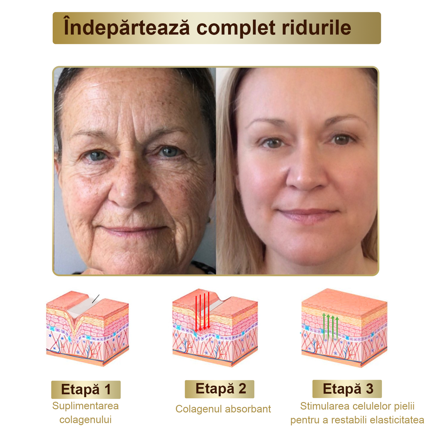 Doar 5 borcane! Prinde acum 30% reducere și obține o piele tânără și strălucitoare în 1-4 săptămâni. Nu rata oferta—nu se va repeta! Garanție returnare bani 180 de zile!