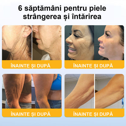 💃🏻𝐁𝐒𝐖𝐄𝐋𝐋® 𝐀𝐝𝐯𝐚𝐧𝐜𝐞𝐝 𝐅𝐢𝐫𝐦𝐢𝐧𝐠 & 𝐖𝐫𝐢𝐧𝐤𝐥𝐞-𝐑𝐞𝐝𝐮𝐜𝐢𝐧𝐠 𝐂𝐫𝐞𝐚𝐦: 𝐑𝐞𝐟𝐚𝐜𝐞 𝐞𝐥𝐚𝐬𝐭𝐢𝐜𝐢𝐭𝐚𝐭𝐞𝐚 𝐩𝐢𝐞𝐥𝐢𝐢 (👩🏻‍⚕️𝐑𝐞𝐜𝐨𝐦𝐦𝐞𝐧𝐝𝐞𝐝 𝐝𝐞 𝐜ă𝐭𝐫𝐞 𝐝𝐞𝐫𝐦𝐚𝐭𝐨𝐥𝐨𝐠𝐢&🔥𝐒𝐮𝐧𝐭 î𝐧 𝐜𝐮𝐫𝐬 𝐝𝐞 𝐝𝐞𝐬𝐟ăș𝐮𝐫𝐚𝐫𝐞 𝐩𝐫𝐨𝐦𝐨ț𝐢𝐢𝐥𝐞 𝐝𝐞 𝐯𝐚𝐫ă!)