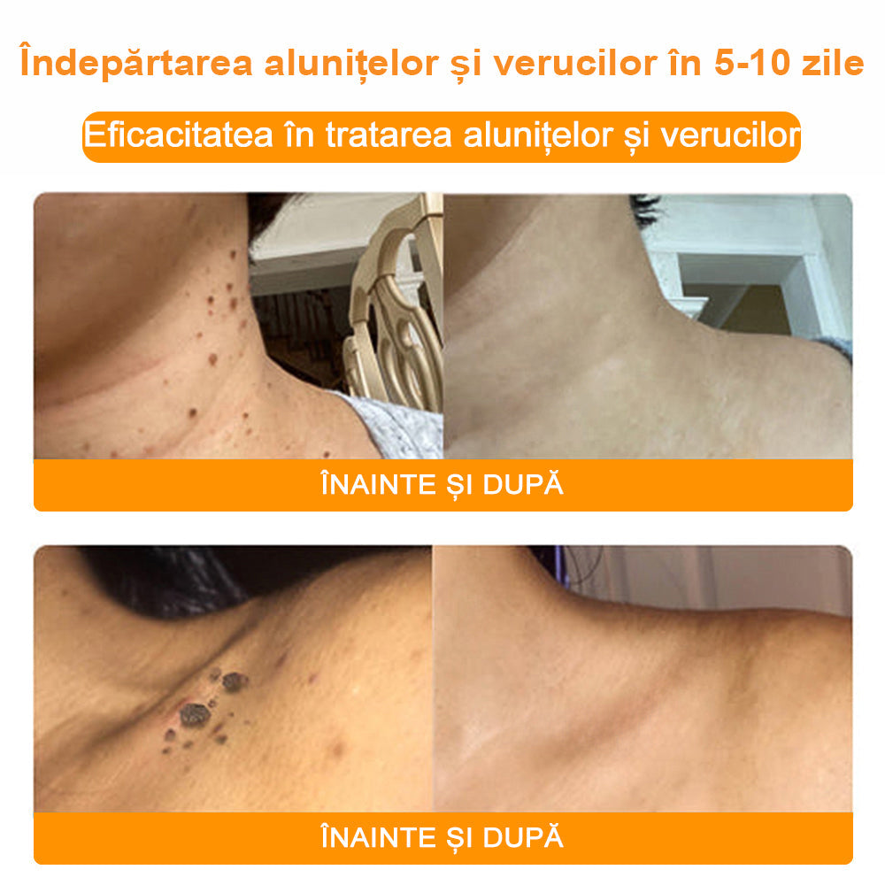 💎 𝐁𝐒𝐖𝐄𝐋𝐋® Cremă de tratare a pielii cu venin de albine (𝑆𝑢𝑔𝑒𝑟𝑎𝑡 𝑑𝑒 𝐼𝑁𝑆𝑃)