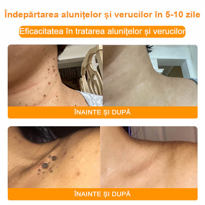 💎 𝐁𝐒𝐖𝐄𝐋𝐋® Cremă de tratare a pielii cu venin de albine (𝑆𝑢𝑔𝑒𝑟𝑎𝑡 𝑑𝑒 𝐼𝑁𝑆𝑃)