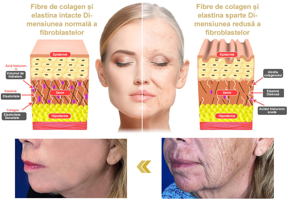 💃🏻𝐁𝐒𝐖𝐄𝐋𝐋® 𝐀𝐝𝐯𝐚𝐧𝐜𝐞𝐝 𝐅𝐢𝐫𝐦𝐢𝐧𝐠 & 𝐖𝐫𝐢𝐧𝐤𝐥𝐞-𝐑𝐞𝐝𝐮𝐜𝐢𝐧𝐠 𝐂𝐫𝐞𝐚𝐦: 𝐑𝐞𝐟𝐚𝐜𝐞 𝐞𝐥𝐚𝐬𝐭𝐢𝐜𝐢𝐭𝐚𝐭𝐞𝐚 𝐩𝐢𝐞𝐥𝐢𝐢 (👩🏻‍⚕️𝐑𝐞𝐜𝐨𝐦𝐦𝐞𝐧𝐝𝐞𝐝 𝐝𝐞 𝐜ă𝐭𝐫𝐞 𝐝𝐞𝐫𝐦𝐚𝐭𝐨𝐥𝐨𝐠𝐢&🔥𝐒𝐮𝐧𝐭 î𝐧 𝐜𝐮𝐫𝐬 𝐝𝐞 𝐝𝐞𝐬𝐟ăș𝐮𝐫𝐚𝐫𝐞 𝐩𝐫𝐨𝐦𝐨ț𝐢𝐢𝐥𝐞 𝐝𝐞 𝐯𝐚𝐫ă!)