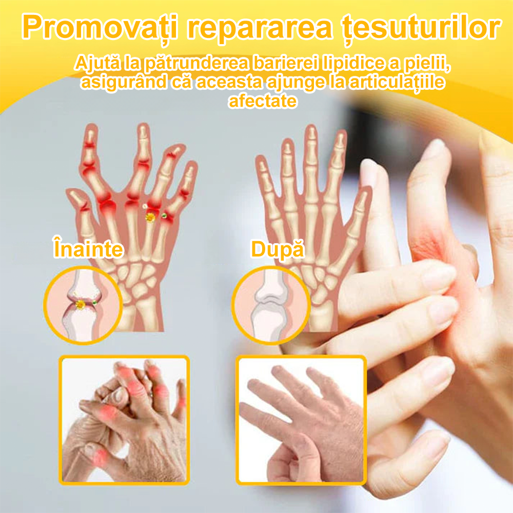 💪𝐅𝐥𝐞𝐱𝐢𝐑𝐞𝐥𝐢𝐞𝐟® 𝐕𝐞𝐧𝐢𝐧 𝐝𝐞 𝐀𝐥𝐛𝐢𝐧𝐞 𝐀𝐯𝐚𝐧𝐬𝐚𝐭ă 𝐀𝐫𝐭𝐢𝐜𝐮𝐥𝐚ț𝐢𝐢𝐥𝐨𝐫 ș𝐢 𝐎𝐚𝐬𝐞𝐥𝐨𝐫 𝐓𝐞𝐫𝐚𝐩𝐢𝐚 𝐂𝐫𝐞𝐦ă  (𝐞𝐱𝐭𝐫𝐚𝐜𝐭 𝐝𝐞 𝐚𝐥𝐛𝐢𝐧𝐞 𝐝𝐢𝐧 𝐧𝐨𝐮𝐚 𝐳𝐞𝐞𝐥𝐚𝐧𝐝ă - 𝐞𝐬𝐭𝐞 𝐬𝐩𝐞𝐜𝐢𝐚𝐥𝐢𝐳𝐚𝐭 î𝐧 𝐛𝐨𝐥𝐢 𝐨𝐫𝐭𝐨𝐩𝐞𝐝𝐢𝐜𝐞 ș𝐢 𝐝𝐮𝐫𝐞𝐫𝐢 𝐚𝐫𝐭𝐫𝐢𝐭𝐢𝐜𝐞) 💖💖