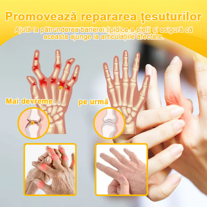 𝐁𝐒𝐖𝐄𝐋𝐋® Venin de Albine Alinarea Durerii Vindecarea Oaselor Cremă🌱𝐀𝐀𝐎𝐒 recomandă (Specializat în boli ortopedice și dureri)🌈